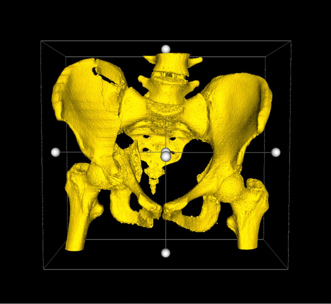 DICOM 3D Screenshot