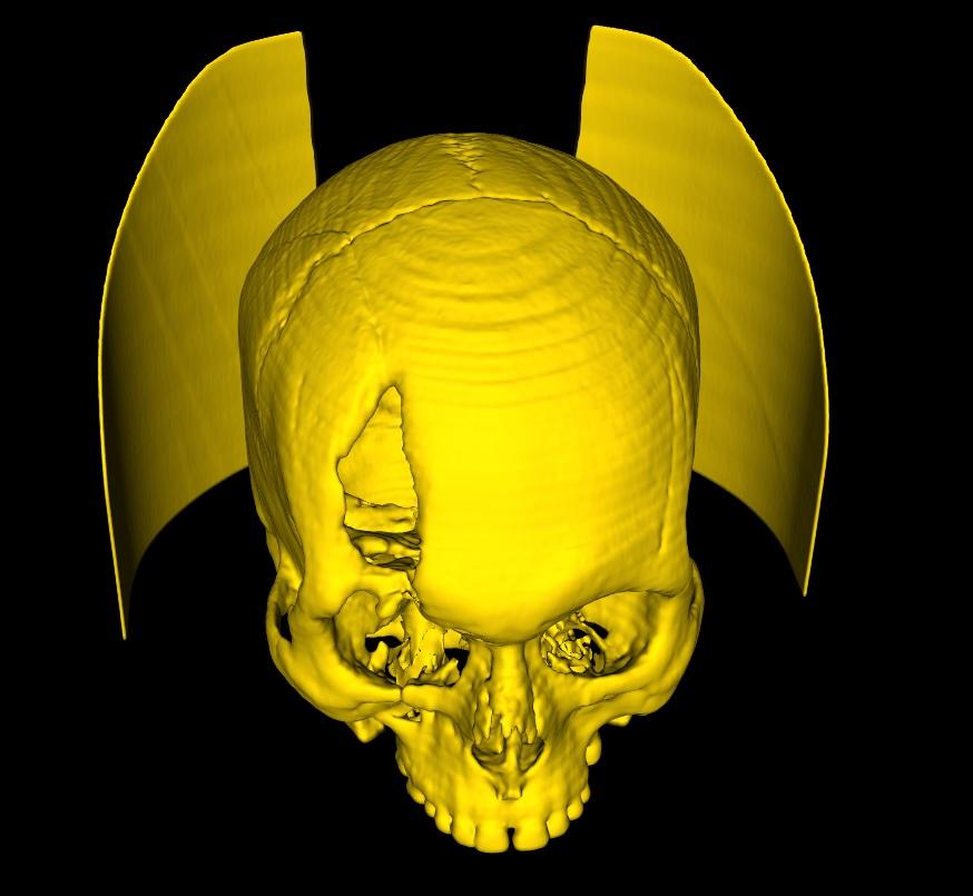 DICOM 3D Screenshot