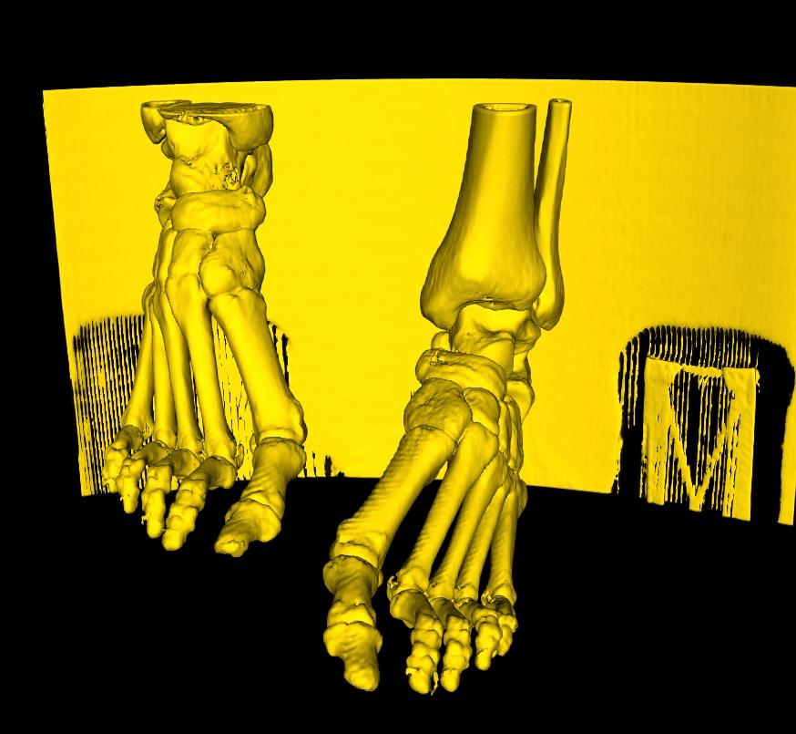 DICOM 3D Screenshot