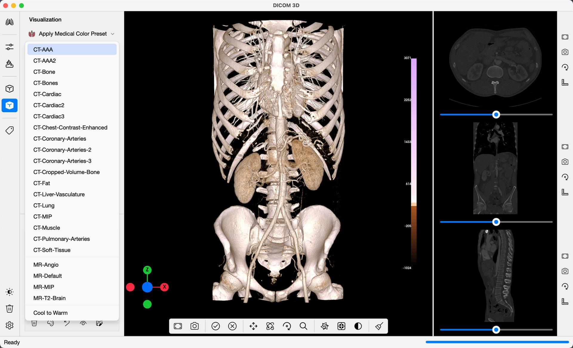 DICOM 3D