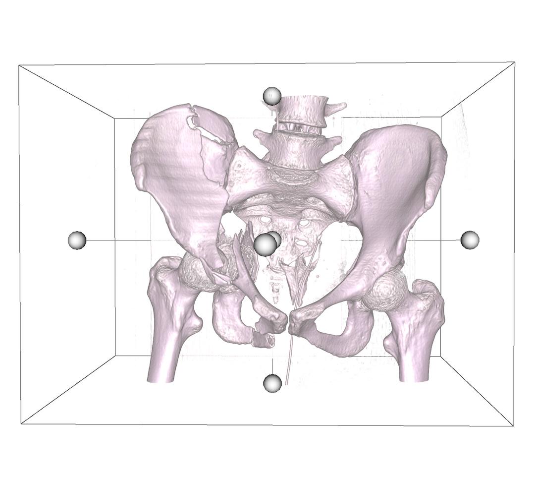 DICOM 3D Screenshot