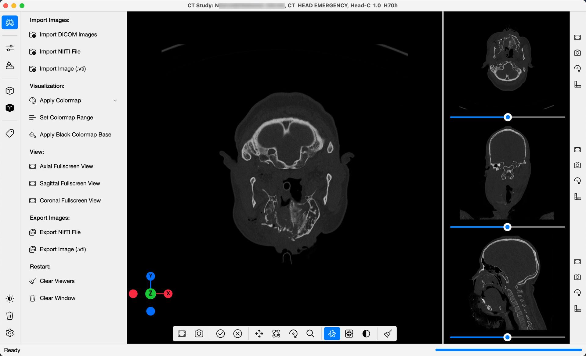 DICOM 3D