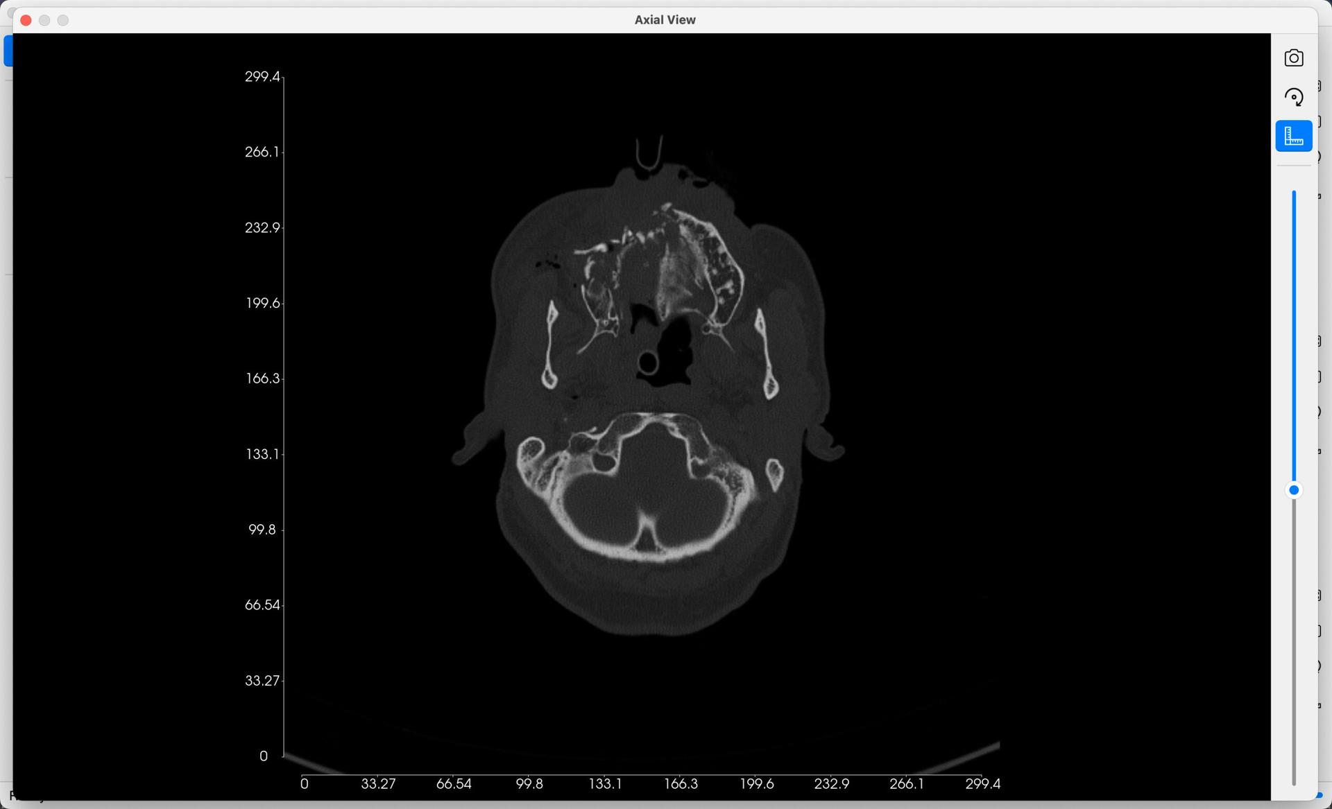 DICOM 3D