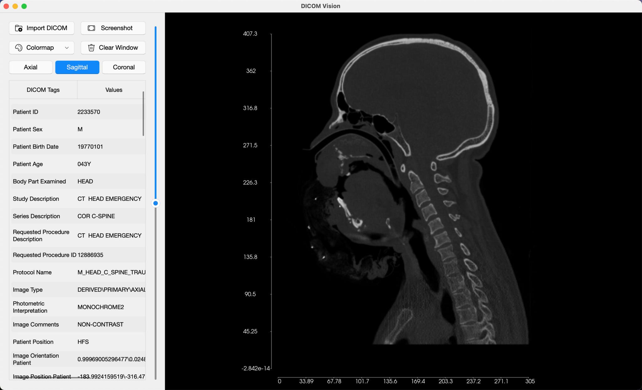 DICOM Vision