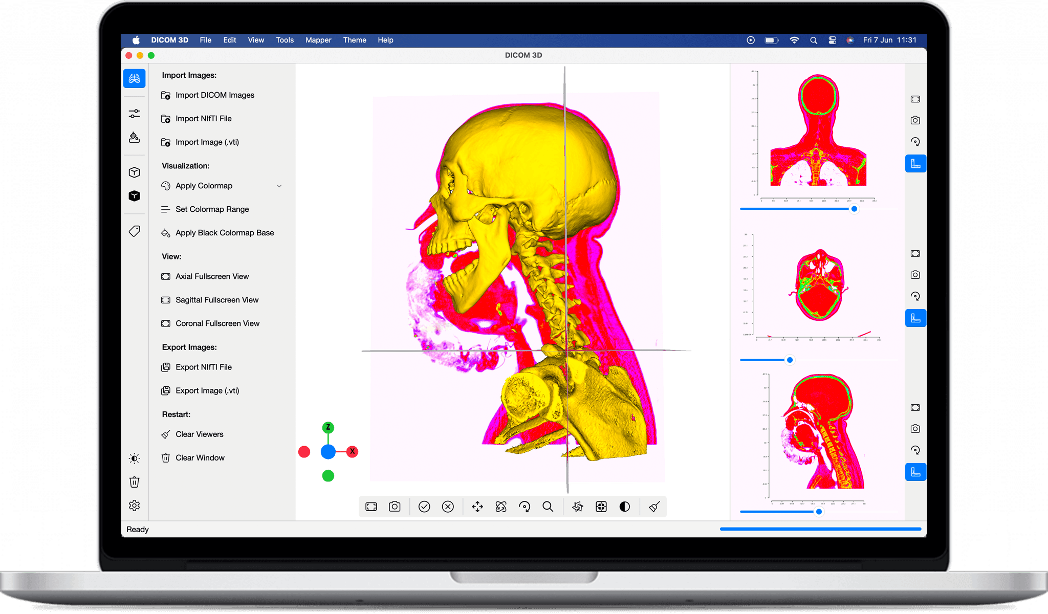 DICOM 3D