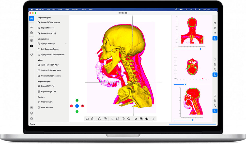 DICOM 3D