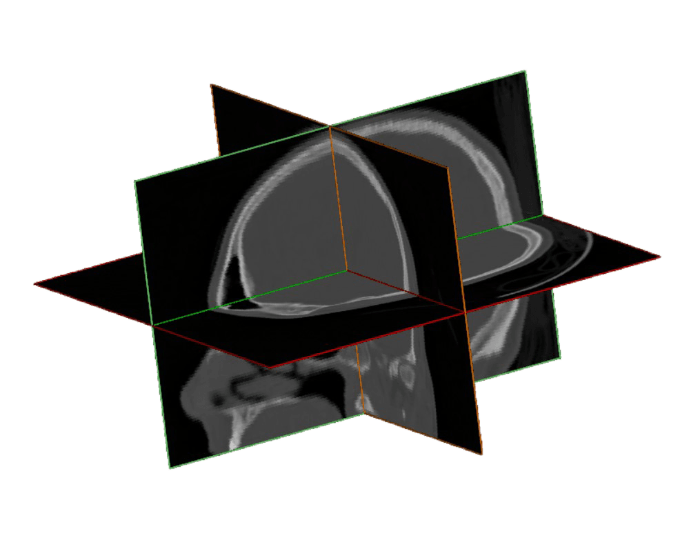 DICOM Slices stacked in 3D