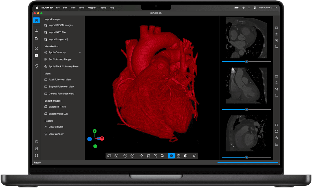 DICOM 3D