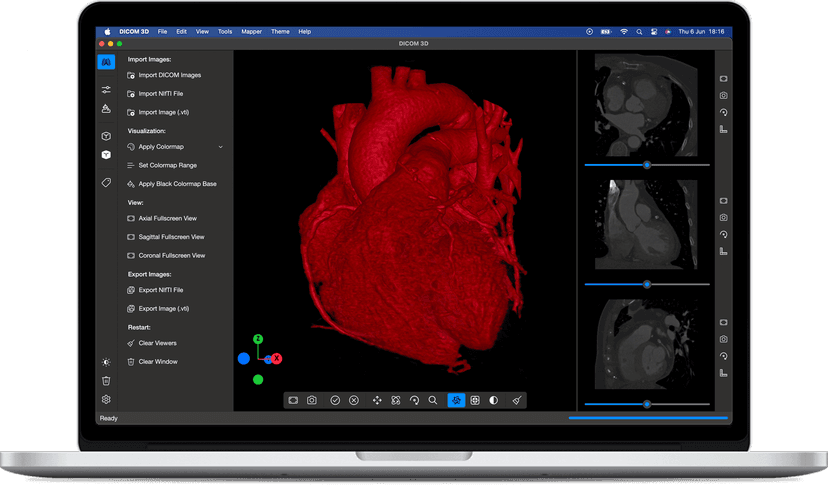 DICOM 3D