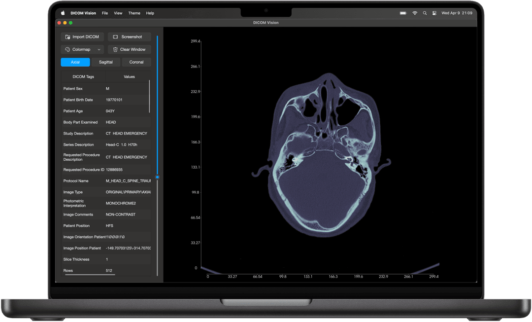 DICOM Vision