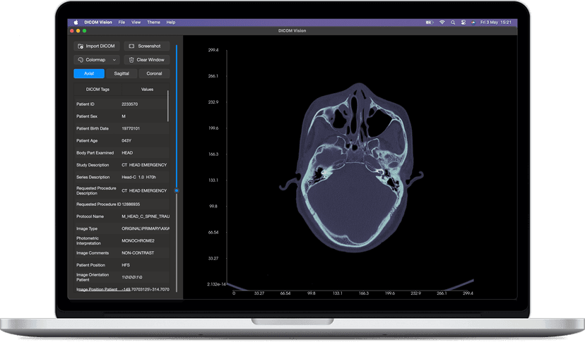 DICOM Vision