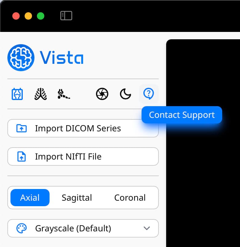 Contact Support button on Vista