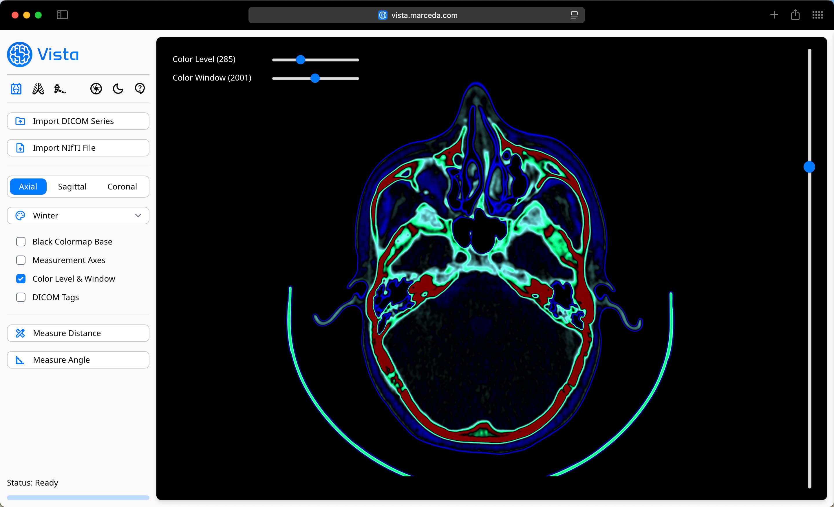 Winter Colormap Applied to images in Vista, with the Color Level & Window adjusted