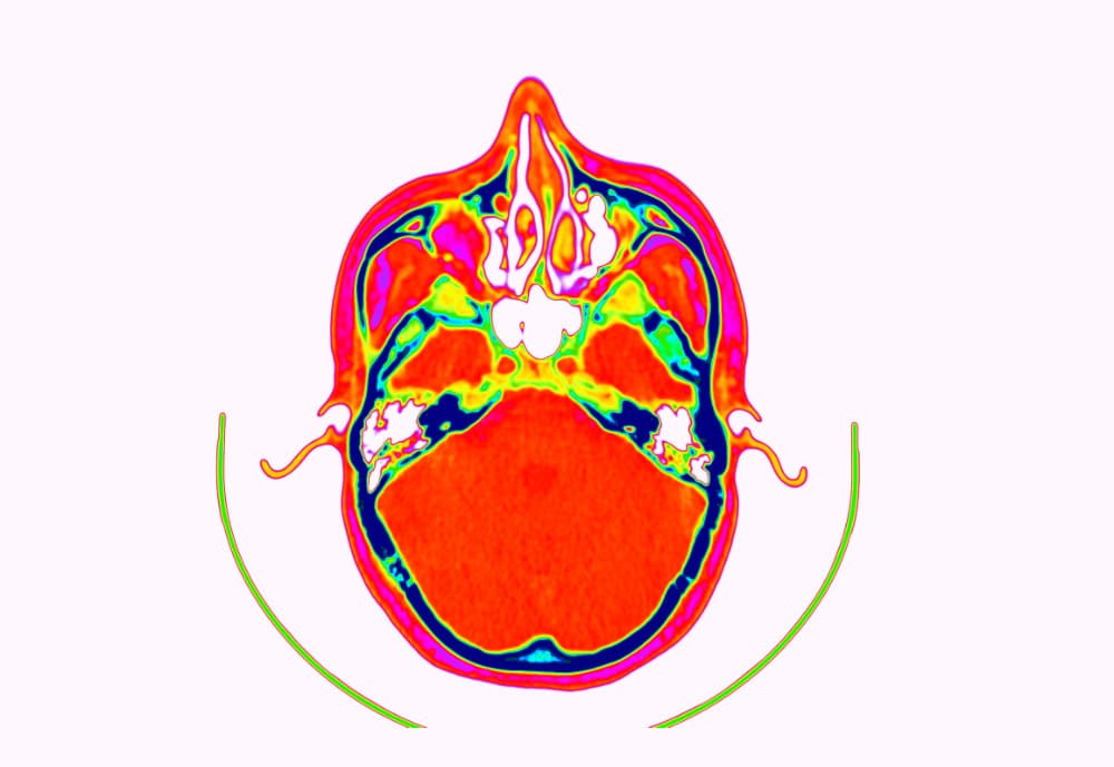 DICOM Image with 'Gist_ncar_r' colormap applied