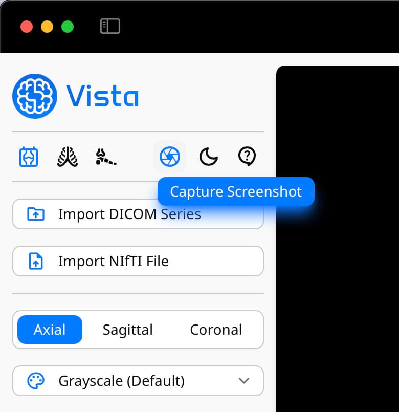 Capture Screenshot button on Vista