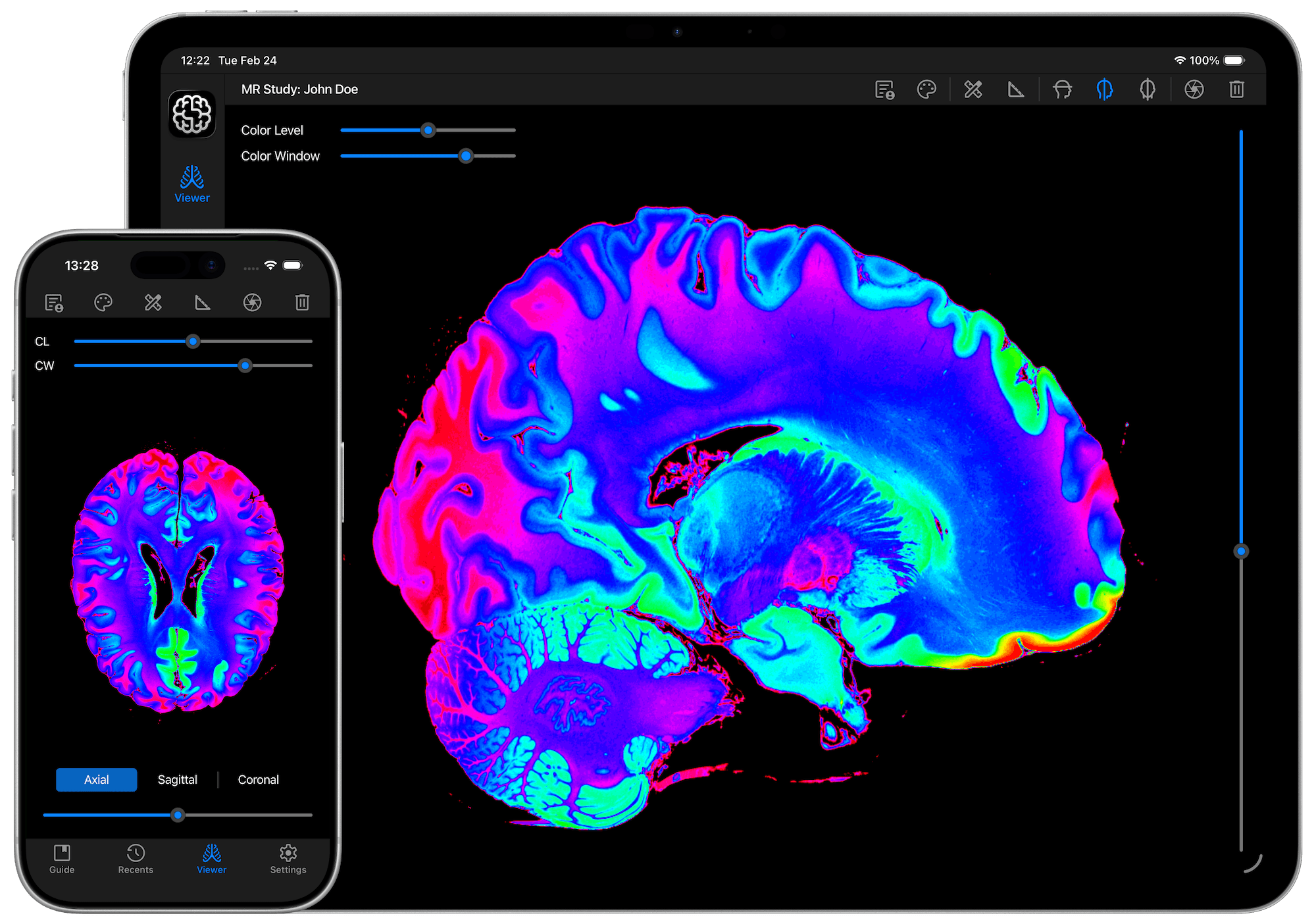 DICOM Studio Go on iPhone & iPad