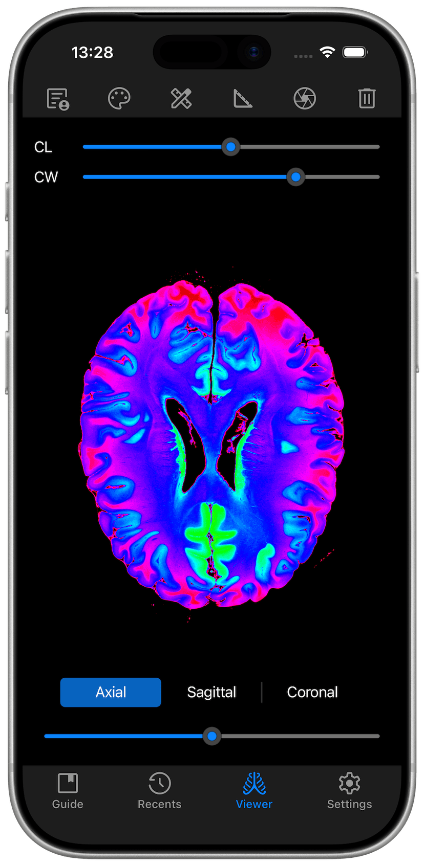 DICOM Studio Go on iPhone - Axial View