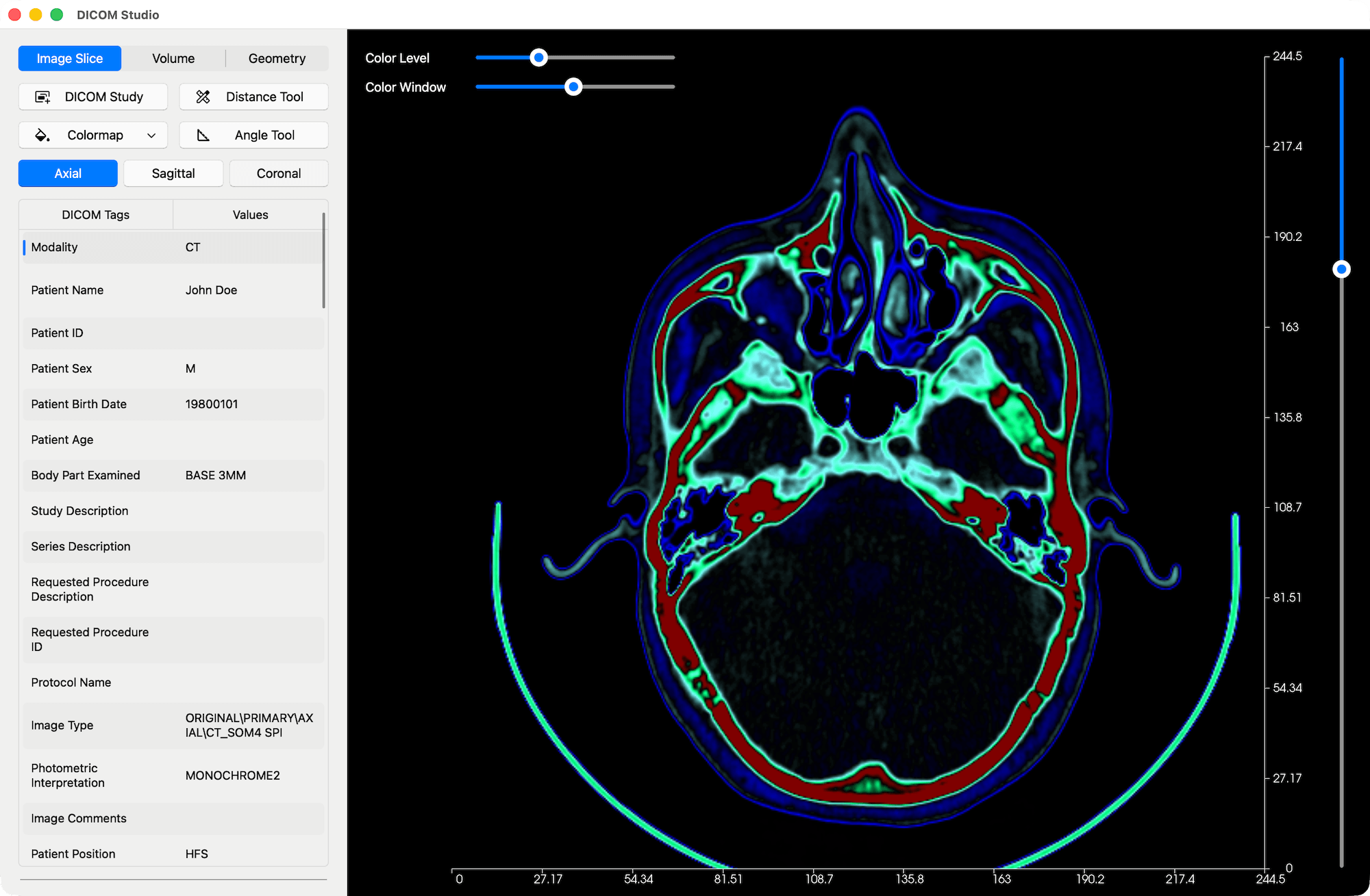 Color Level and Color Window adjustments on a DICOM Slice - DICOM Studio