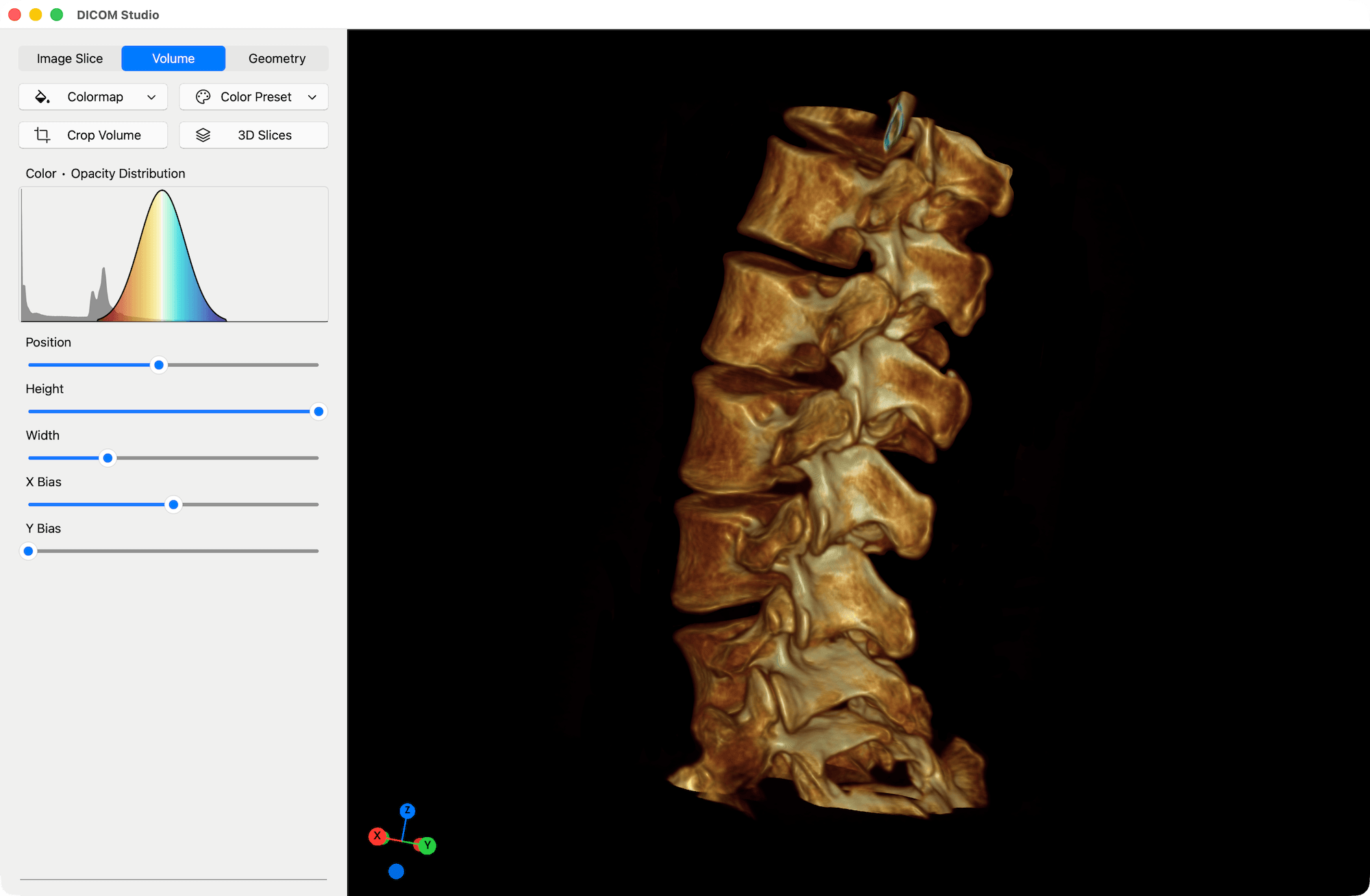 Volumetric Colormap - DICOM Studio