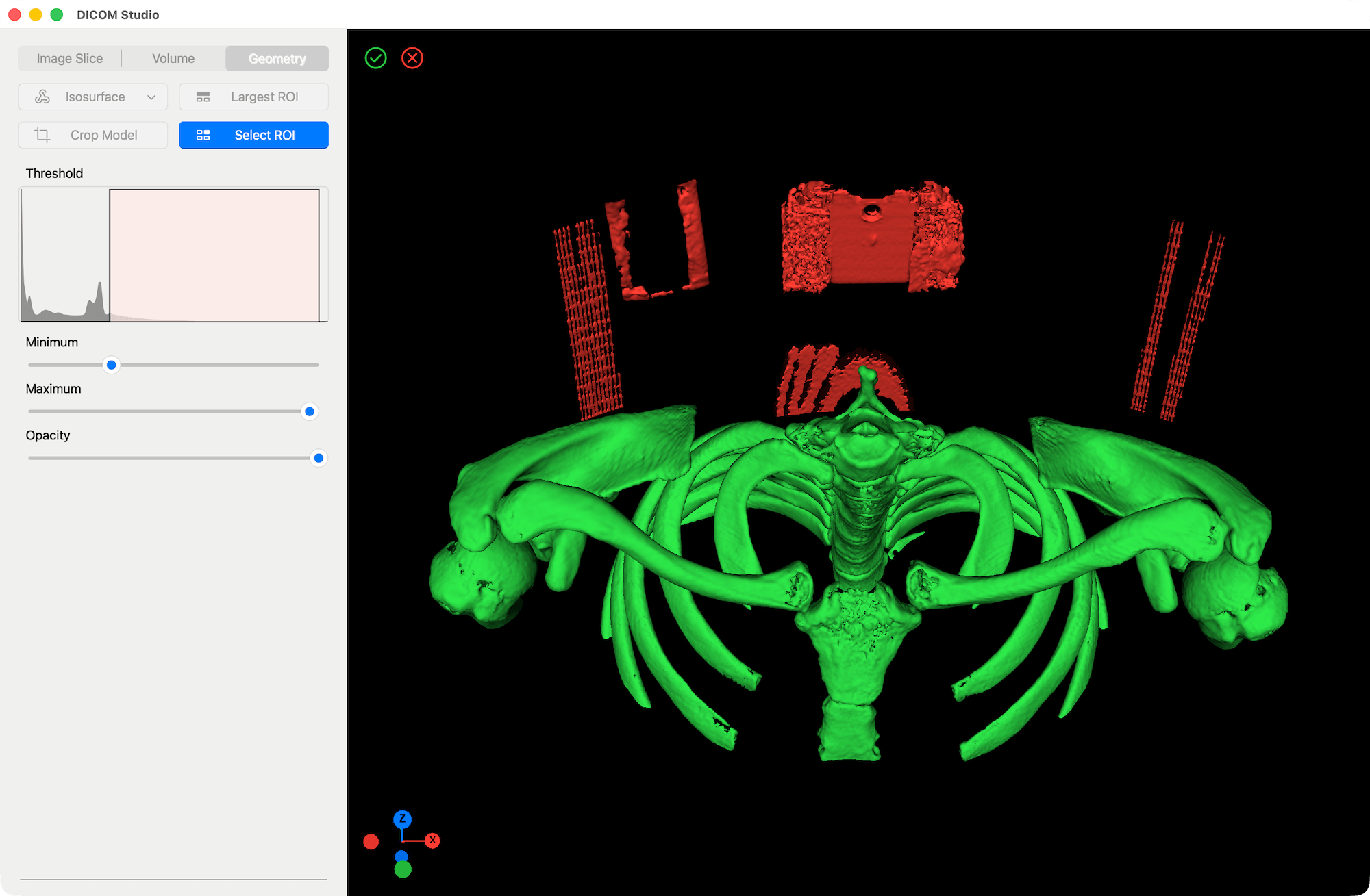 Select Region of Interest - DICOM Studio