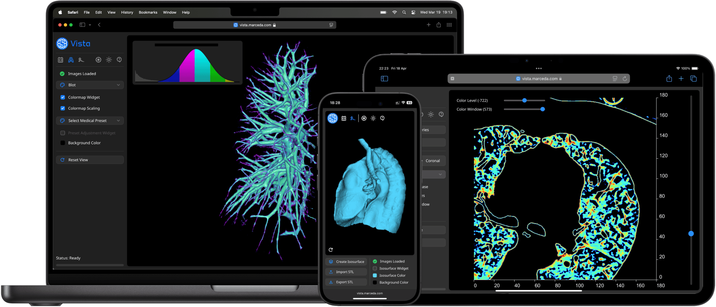 Vista on Mac, iPhone & iPad