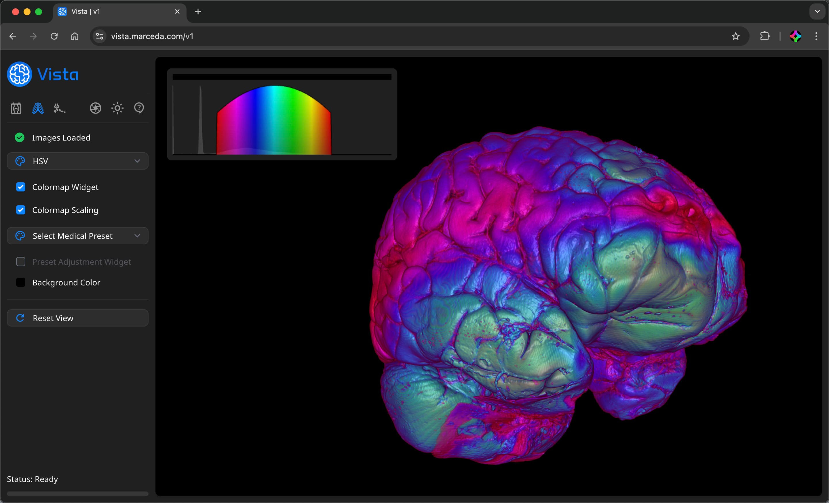 Vista - Volume Viewer Profile
